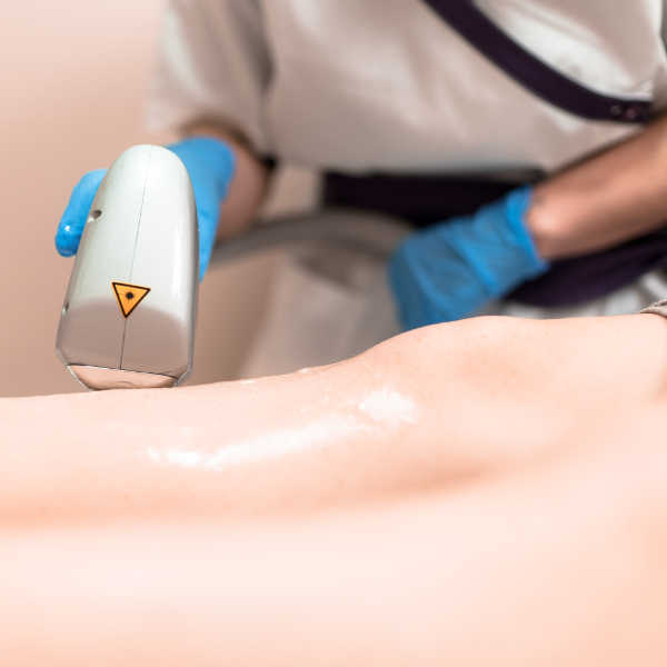 endovenous-laser-treatment endovenous ablation